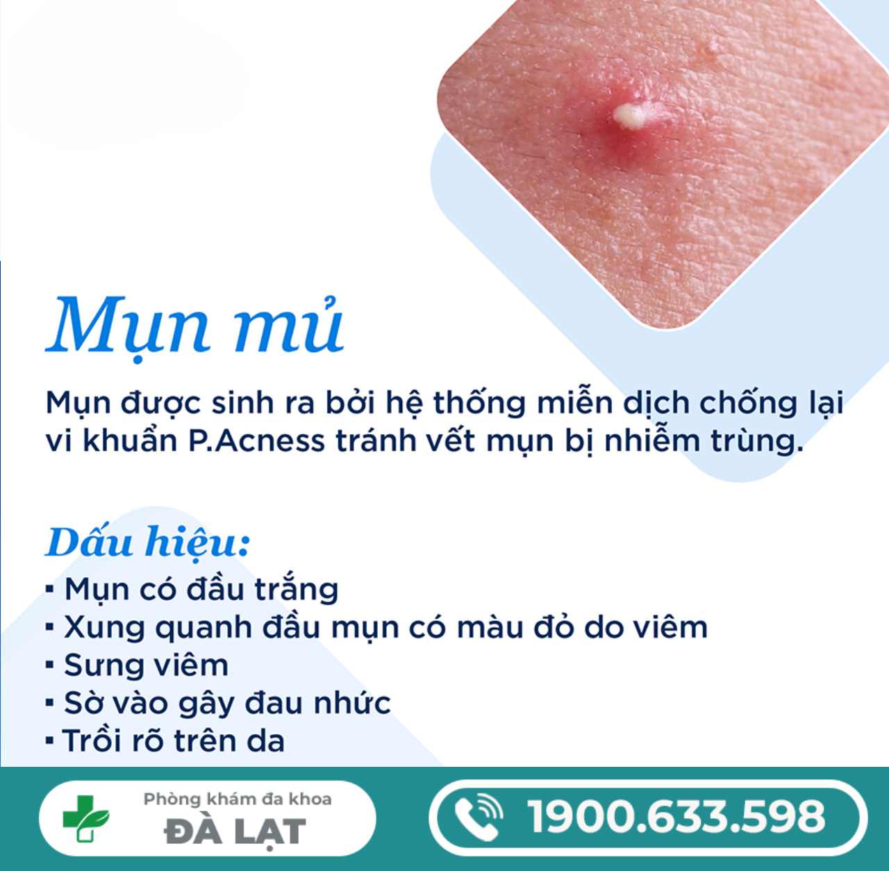 Hình ảnh minh họa